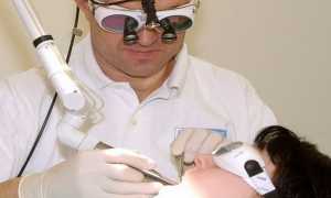 Как удаляют гланды и когда это нужно?