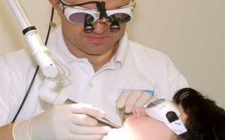 Как удаляют гланды и когда это нужно?