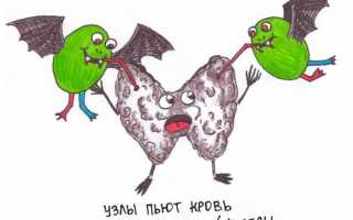 Узел щитовидной железы с кровотоком