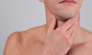 Последствия удаления щитовидки у мужчин