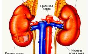 Гиперплазия коры надпочечников