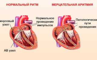 Возможные осложнения ЭКС у взрослых и детей