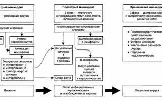 Специфический аллергический миокардит: признаки, симптомы и лечение