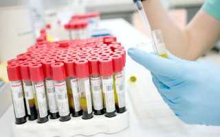 Расшифровка анализов щитовидной железы