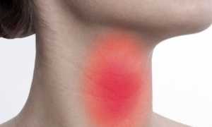 Первичный гипотиреоз