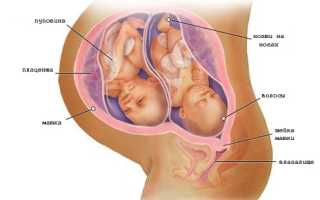 Сахар в моче у беременных