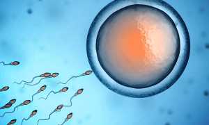 Что такое астенозооспермия?