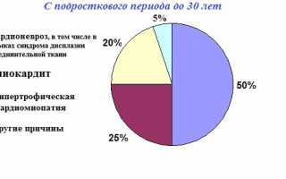 Варианты проявления желудочковой экстрасистолии и методы лечения