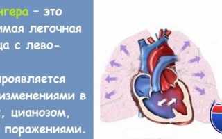 Опасное изменение положения аорты, которое можно исправить в самом начале — синдром Эйзенменгера