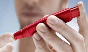 Гипергликемия – что это такое?