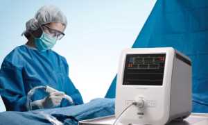 Пункция при биопсии молочной железы