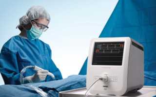 Пункция при биопсии молочной железы