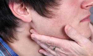 Лечение воспаленных миндалин в домашних условиях