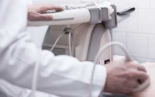 Как подготовиться к УЗИ поджелудочной железы?