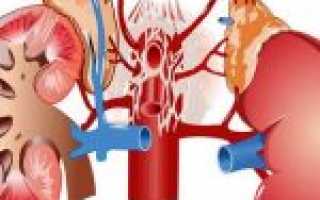 Факторы риска атеросклероза почечных артерий и методы борьбы с патологией