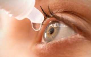 Синдром сухого глаза: причины заболевания, как оно проявляется и какими каплями лечится