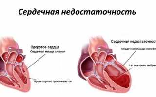 Основное применение Добутамина и его особенности