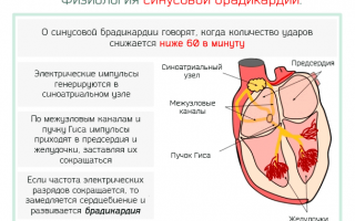 Все тонкости и нюансы операции по установке кардиостимулятора, советы по восстановлению и возможные осложнения