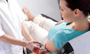 Повышенные и пониженный значения ТТГ, Т3 и Т4