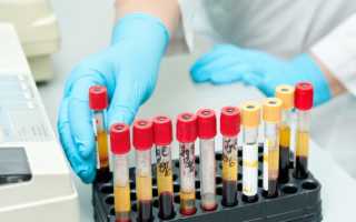 Как сдать анализ крови на сахар правильно?