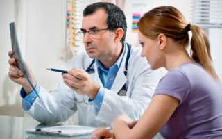 Перекрут яичника