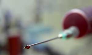 Повышенный пролактин и зачатие