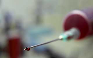 Повышенный пролактин и зачатие