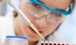 Повышенный ТТГ