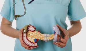 Какой врач лечит панкреатит?