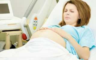 Предстоящая беременность и пороки сердца: все, что нужно знать будущей маме
