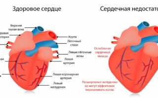 Народные средства при сердечной недостаточности