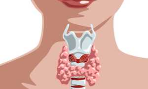 Какие анализы сдают для проверки щитовидки?