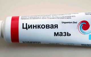 Появился ушиб, синяк, гематома? Все поправимо, если правильно подобрать средство!