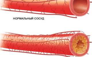 Как подобрать препараты для сосудов головы