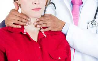 Может ли рассосаться узел в щитовидной железе