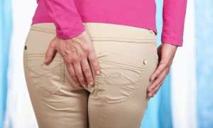 К какому врачу идти с геморроем?