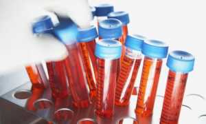 Нормальный уровень сахара в крови у взрослых