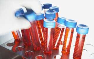 Нормальный уровень сахара в крови у взрослых