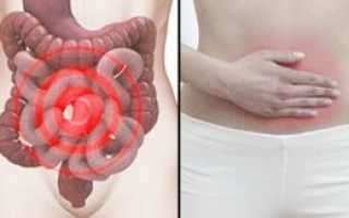 Почему во время менструации может болеть кишечник?