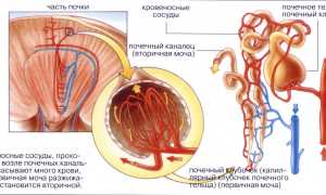 Несахарный диабет