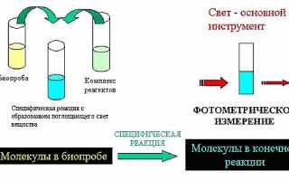 Зачем и кому назначают сделать ионограмму