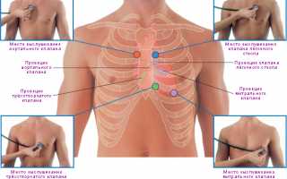 Правила проведения аускультации сердца и результаты