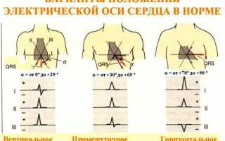 О каких проблемах расскажет электрическая ось сердца