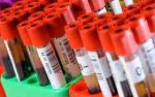 Кому и зачем определяют протромбиновое время