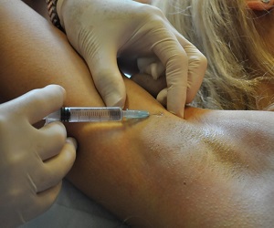 гипергидроз лечение ботоксом