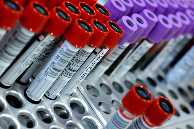 Анализ крови