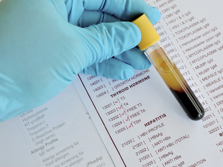 Анализ крови