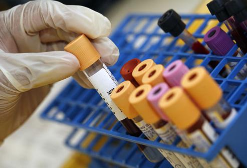 Анализ крови