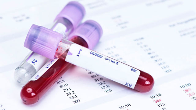 Анализ крови