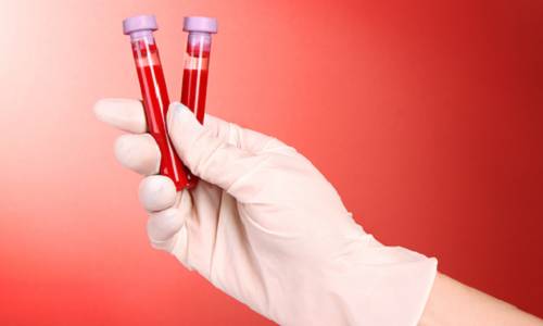 Анализ крови